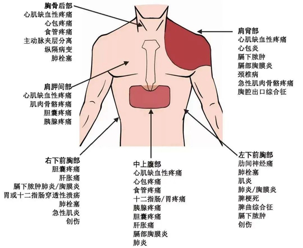 胸口疼痛部位对照表