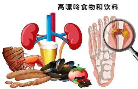 痛风寿命一般能活多久
