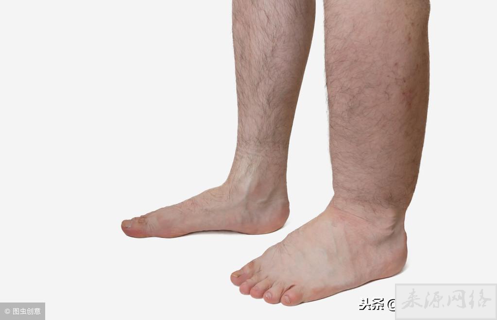 肝病早期可能有6个征兆