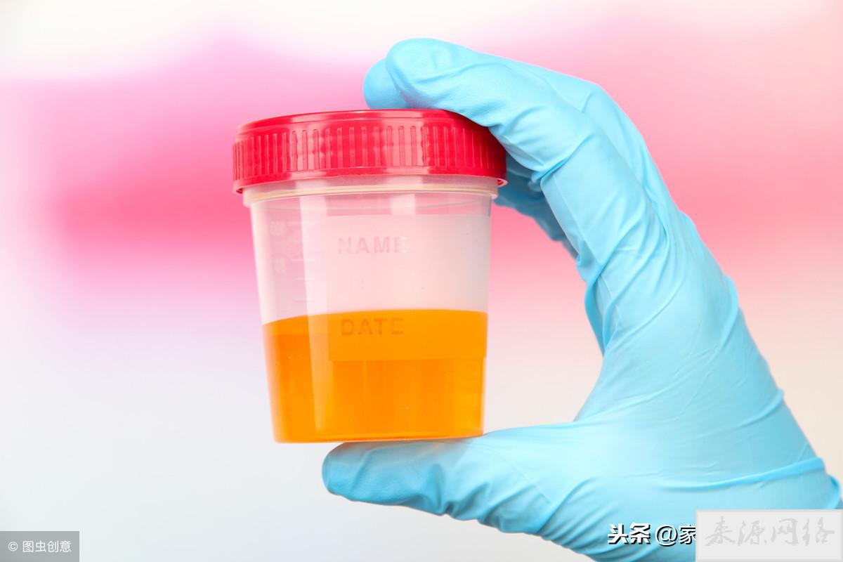 肝病早期可能有6个征兆