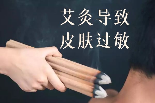 艾灸的副作用