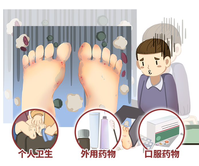 脚气怎么治疗能除根