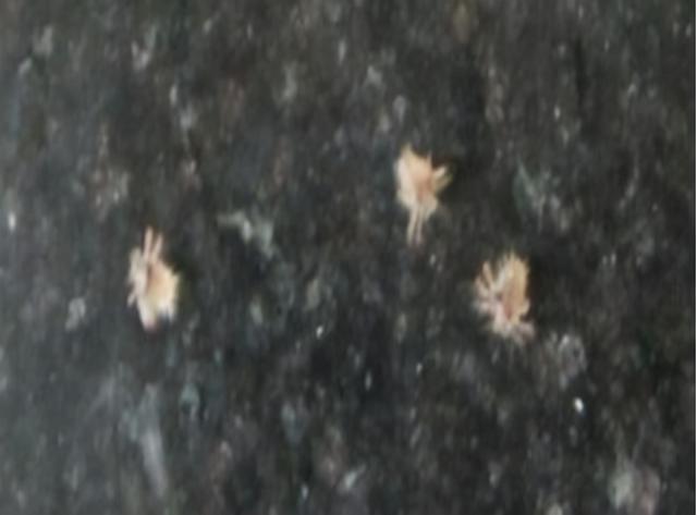 阴虱是什么原因得的