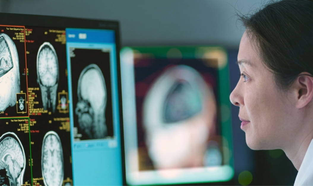 UCLA Health｜精准干预推动帕金森病治疗新进展