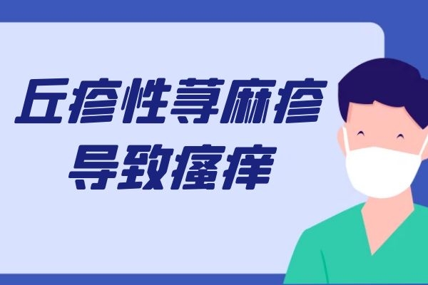 丘疹性荨麻疹症状