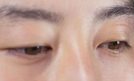 左眼皮老跳是怎么回事