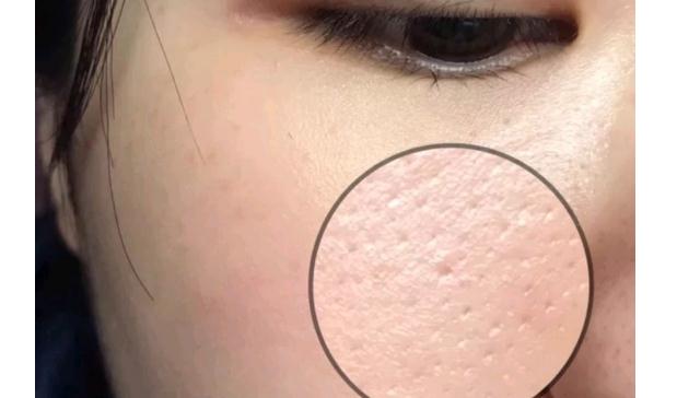怎么选择粉底液色号？干皮能用油皮粉底液吗？