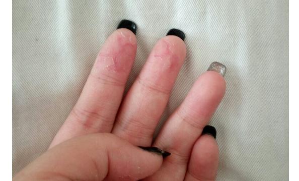 涂指甲油会过敏吗？指甲油会导致灰指甲吗？