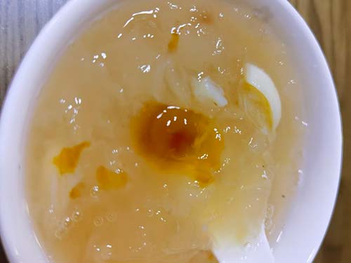 金耳和银耳的区别 金耳的营养价值