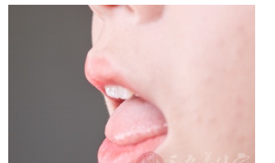 脾胃虚寒的症状有哪些