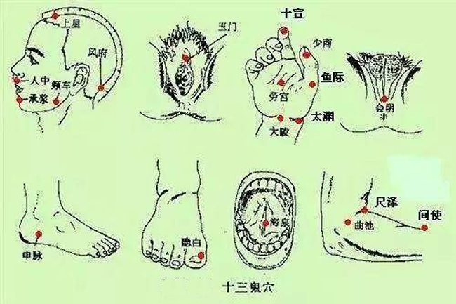 鬼门十三针之十三鬼穴