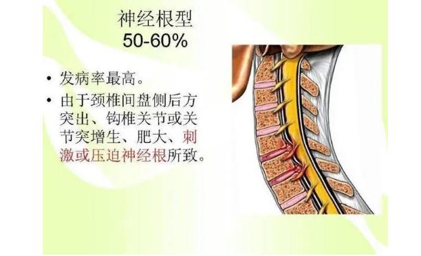 神经根型颈椎病怎么按摩？脊髓型颈椎病怎么按摩？